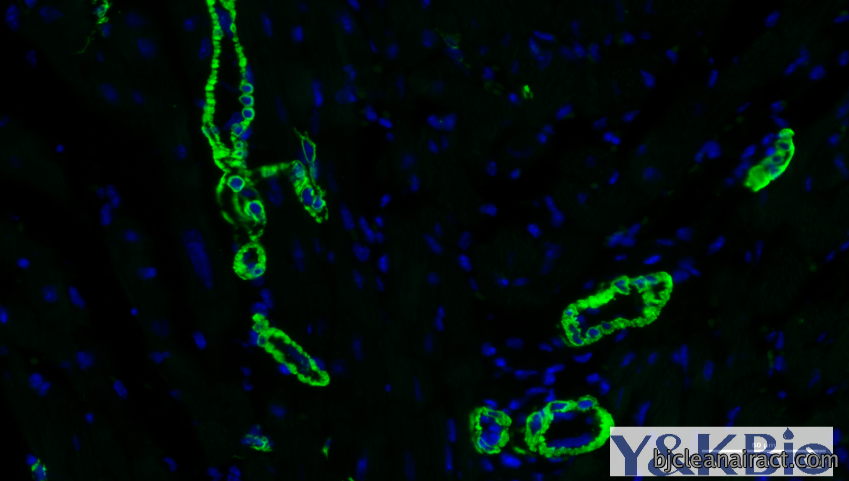 https://img.medsci.cn/09f7f9b396aaea8c5a2398de56f920980d508f8e7313325b130eae0a6c633bd4.png