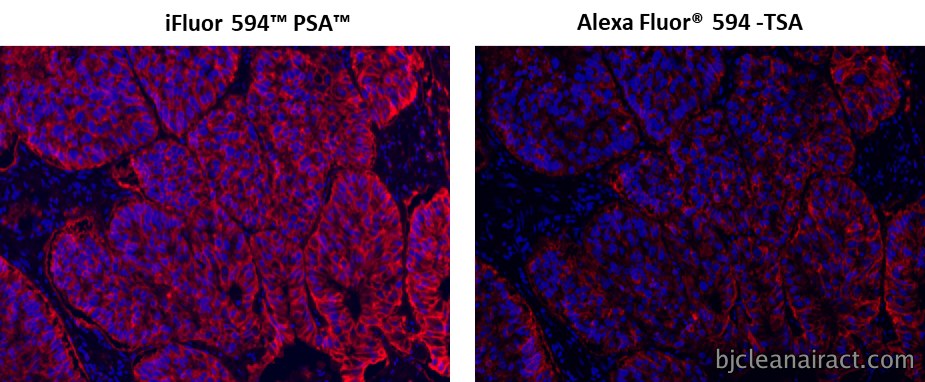 https://img.medsci.cn/e73eefcea40976357f460123cbf1e819c54e5106c9b457225be13b1cbc991aff.png
