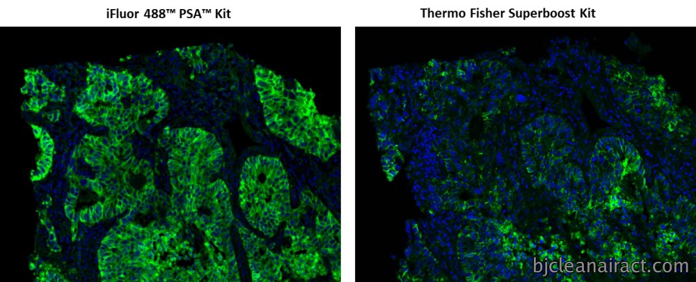 https://img.medsci.cn/e73eefcea40976357f460123cbf1e819c54e5106c9b457225be13b1cbc991aff.png