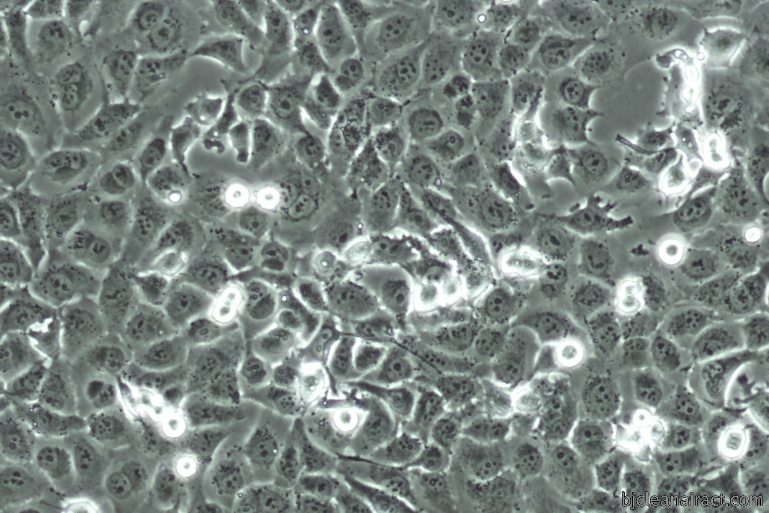 https://img.medsci.cn/89fb048b534fcad8833ccd634f5800a11f7fb953cd1cc43e06fdc674744b57a3.png