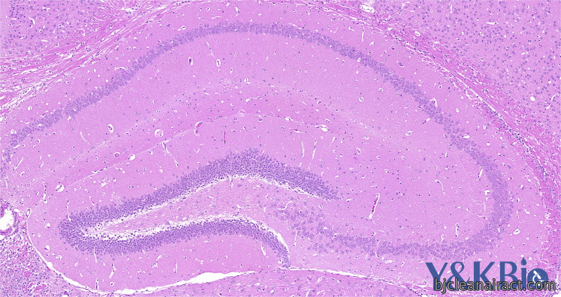 https://img.medsci.cn/09f7f9b396aaea8c5a2398de56f920980d508f8e7313325b130eae0a6c633bd4.png