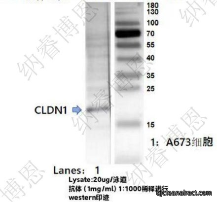 紧密连接核心蛋白CLDN-1单克隆抗体