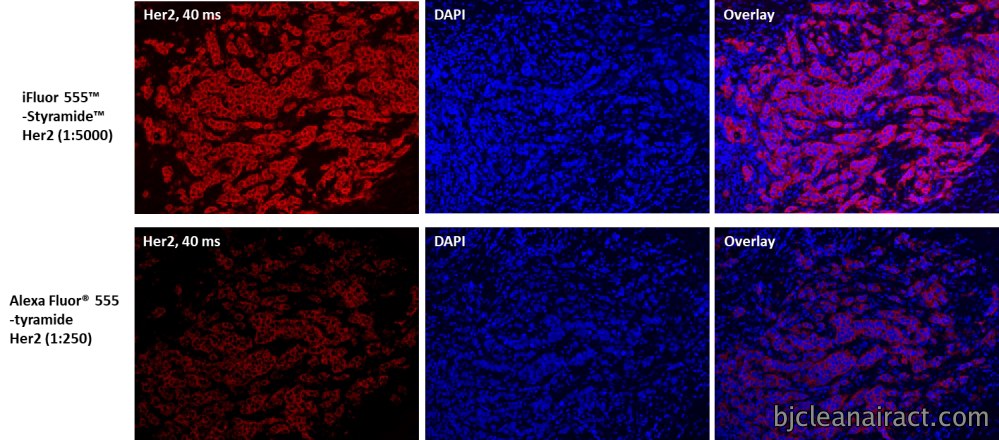 https://img.medsci.cn/e73eefcea40976357f460123cbf1e819c54e5106c9b457225be13b1cbc991aff.png
